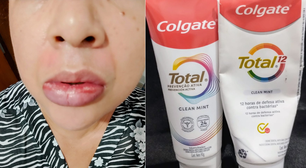 Colgate suspende fabricação de creme dental Clean Mint após reações alérgicas