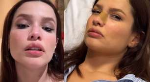 Susto! Juliette sofre fratura no nariz após acidente em casa; veja