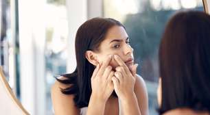 7 dicas para controlar a acne na vida adulta