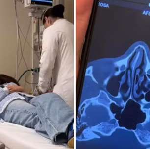 Juliette fratura nariz em acidente doméstico: 'Está meio torto'