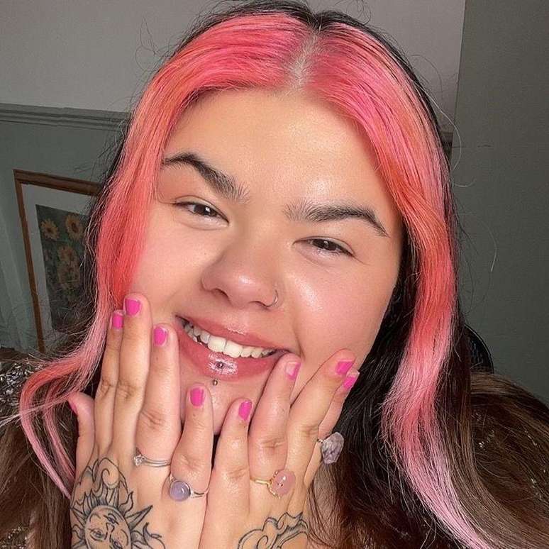 Kayleigh diz que um dos poucos tratamentos que lhe trouxe alívio foi o Botox